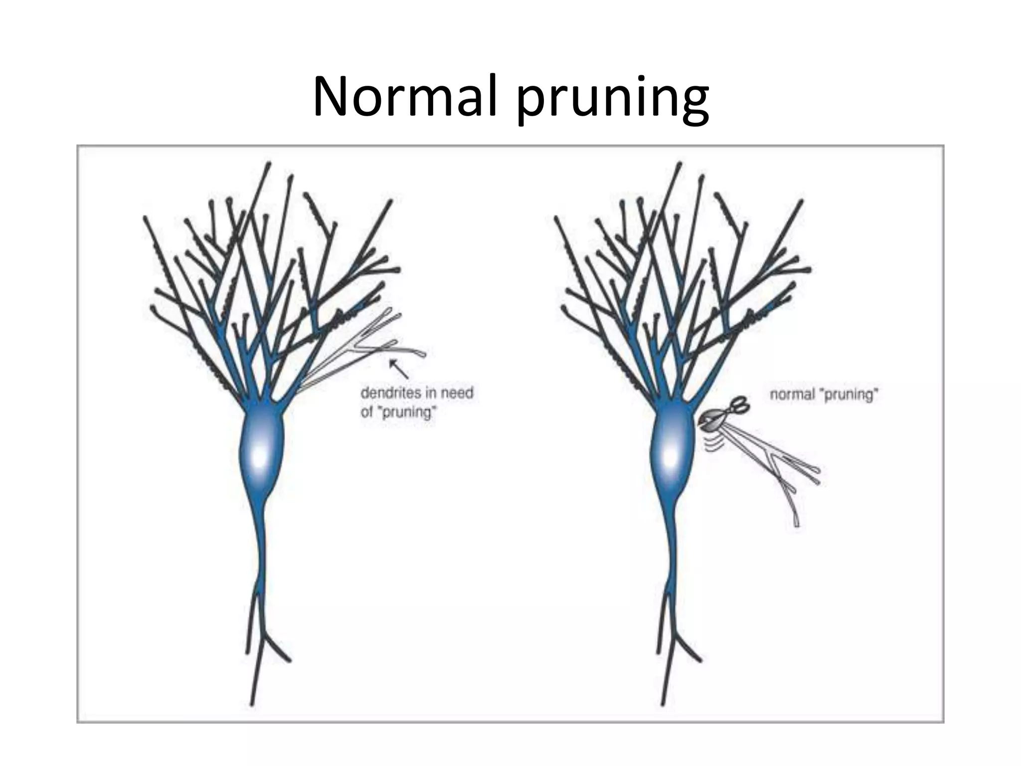 Normal pruning
 