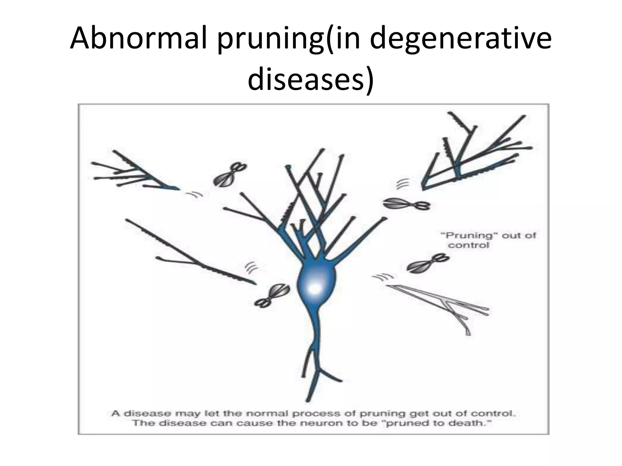 Abnormal pruning(in degenerative
           diseases)
 