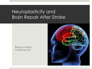 Neuroplasticity and 
Brain Repair After Stroke 
Reagon Heikes 
Physiology 247 
 