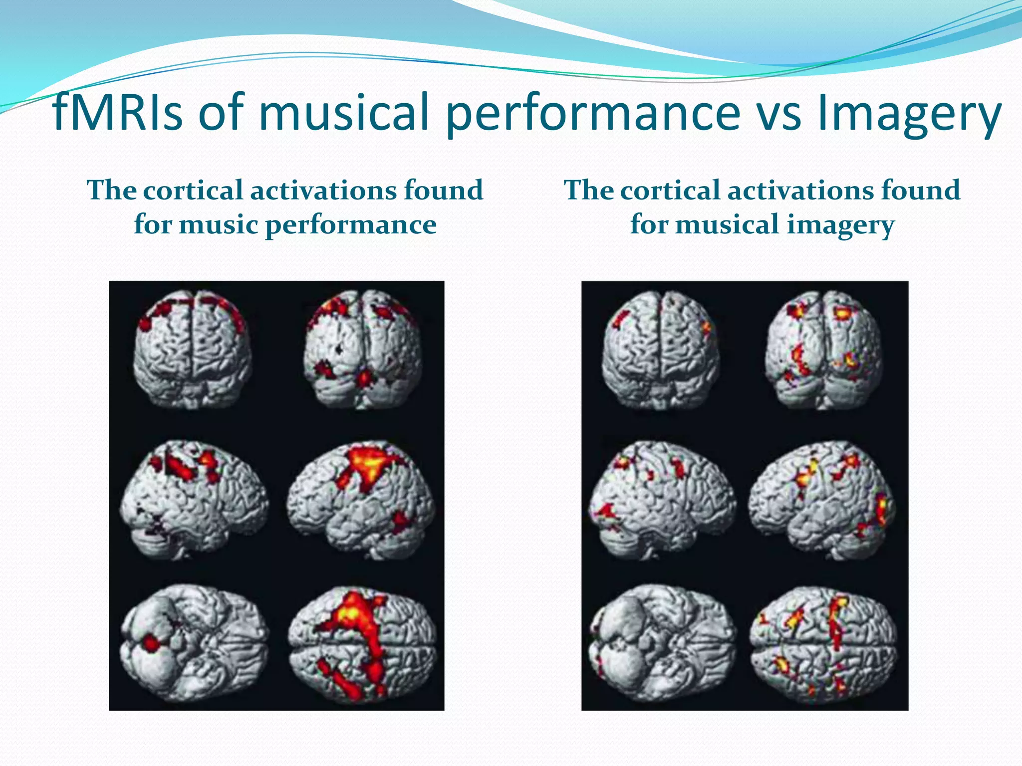 fMRIs of musical performance vs ImageryThe cortical activations found for music performanceThe cortical activations found for musical imagery