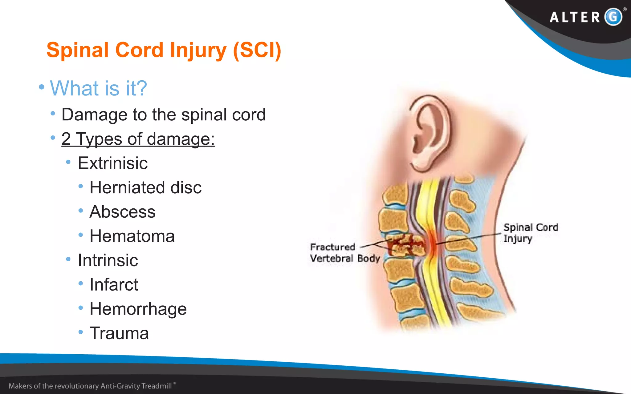 Spinal Cord Injury (SCI)
• What is it?
• Damage to the spinal cord
• 2 Types of damage:
• Extrinisic
• Herniated disc
• Abscess
• Hematoma
• Intrinsic
• Infarct
• Hemorrhage
• Trauma
 