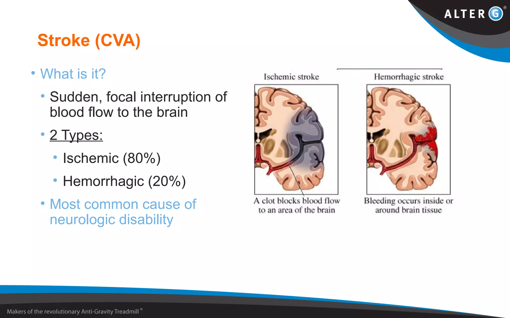 Stroke (CVA)
• What is it?
• Sudden, focal interruption of
blood flow to the brain
• 2 Types:
• Ischemic (80%)
• Hemorrhagic (20%)
• Most common cause of
neurologic disability
 