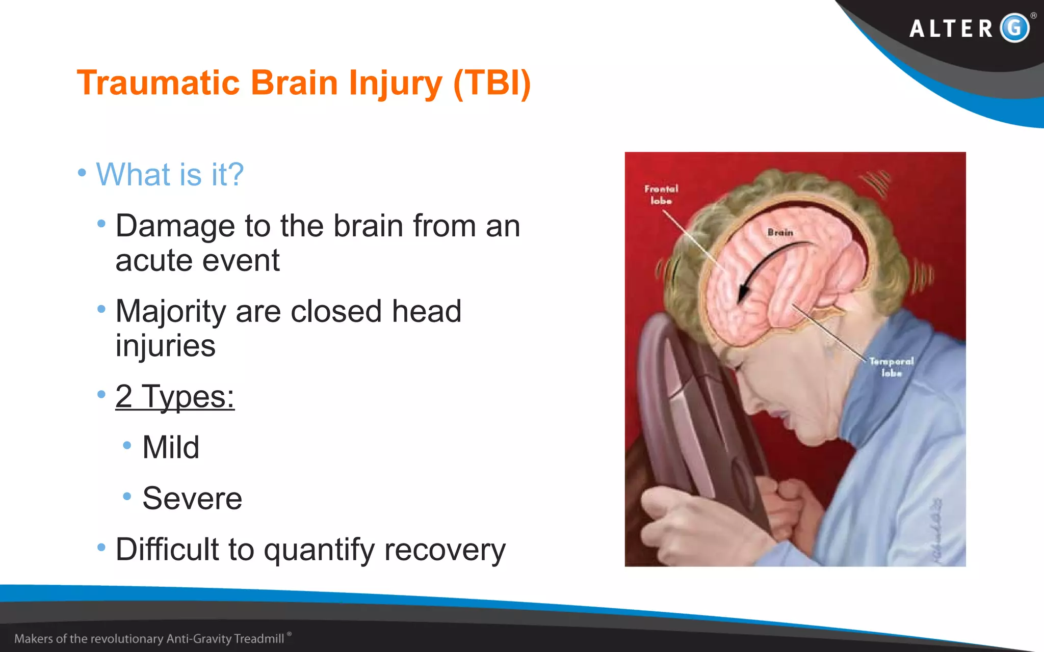 Traumatic Brain Injury (TBI)
• What is it?
• Damage to the brain from an
acute event
• Majority are closed head
injuries
• 2 Types:
• Mild
• Severe
• Difficult to quantify recovery
 