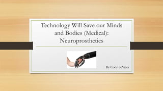 Technology Will Save our Minds
and Bodies (Medical):
Neuroprosthetics
By Cody deVries
 