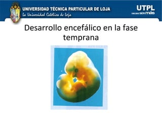 Desarrollo encefálico en la fase temprana 