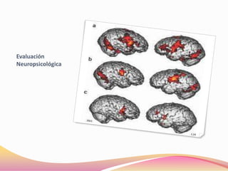Evaluación
Neuropsicológica
 