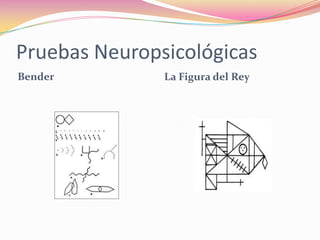 Pruebas Neuropsicológicas
Bender         La Figura del Rey
 