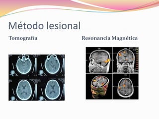 Método lesional
Tomografía        Resonancia Magnética
 