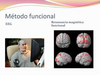 Método funcional
              Resonancia magnética
EEG           funcional
 