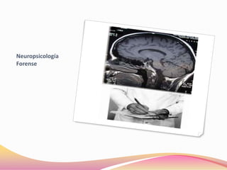 Neuropsicología
Forense
 