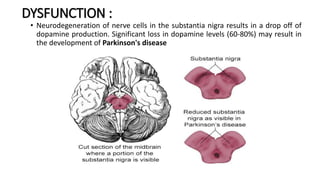 DYSFUNCTION :
• Neurodegeneration of nerve cells in the substantia nigra results in a drop off of
dopamine production. Significant loss in dopamine levels (60-80%) may result in
the development of Parkinson's disease
 