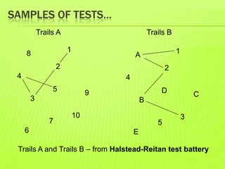 SAMPLES OF TESTS…
Trails A
8
2
4
3
1
9
5
6
10
7
Trails B
A
2
4
B
1
C
D
E
3
5
Trails A and Trails B – from Halstead-Reitan test battery
 