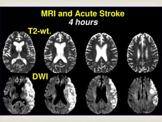Neuro radiology neuroimaging | PPTX