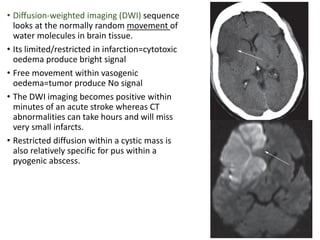 Neuroradiology 1..pdf hdyueieeuheheheheueeu | PDF