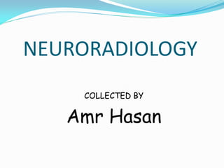 NEURORADIOLOGY
COLLECTED BY
Amr Hasan
 