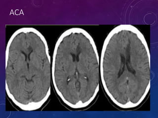 Neuroradiology for the ED | PPTX