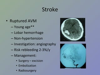 Stroke Ruptured AVM Young age** Lobar hemorrhage Non-hypertension Investigation: angiography Risk rebleeding 2-3%/y Management: Surgery – excision Embolization Radiosurgery 