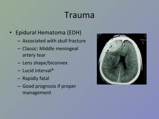 Trauma Epidural Hematoma (EDH) Associated with skull fracture Classic: Middle meningeal artery tear Lens shape/biconvex Lucid interval* Rapidly fatal Good prognosis if proper management 