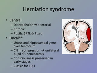 Herniation syndrome Central Diencephalon    tentorial Chronic Pupils: SRTL   Fixed Uncal** Uncus and hippocampal gyrus over tentorium CN III compression    unilateral pupil ↑, hemiparesis Consciousness preserved in early stages Classic for EDH 