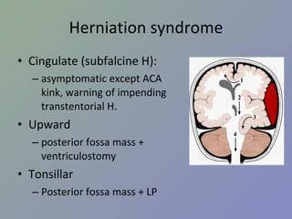 Herniation syndrome Cingulate (subfalcine H):  asymptomatic except ACA kink, warning of impending transtentorial H. Upward posterior fossa mass + ventriculostomy Tonsillar Posterior fossa mass + LP 