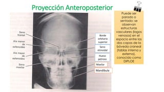 Proyección Anteroposterior
Puede ser
parado o
sentado; se
observan
estructuras
vasculares (lagos
venosos) en el
espacio entre las
dos capas de la
bóveda craneal
(tablas interna y
externa),
conocido como
DIPLOE
Borde
orbitario
superior
Seno
etmoidal
Hueso
petroso
Maxilar
Mandíbula
 