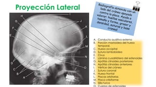 Proyección Lateral
A. Conducto auditivo externo
B. Porción mastoidea del hueso
temporal.
C. Hueso occipital
D. Sutura lambdoidea
E. Civus
F. Lámina cuadrilátera del esfenoides
G. Apófisis clinoides posteriores
H. Apófisis clinoides anteriores
I. Vértice del cráneo
J. Sutura coronal
K. Hueso frontal
L. Placas orbitarias
M. Placa cribiforme
N. Silla turca
O. Cuerpo de esfenoides
 