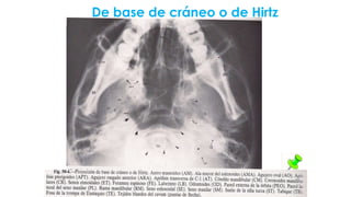 De base de cráneo o de Hirtz
El haz de rayos penetra en la base por un punto entre los ángulos de la mandíbula.
Es útil para visualizar todas las estructuras óseas de la base, tejidos blandos y las
sombras aéreas visibles en la nasofaringe y orofaringe.
 