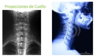 Proyecciones de Cuello
 