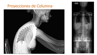 Proyecciones de Columna
 