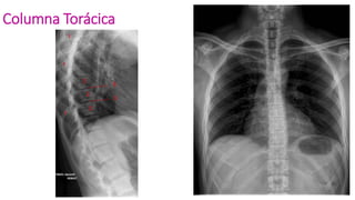Columna Torácica
 