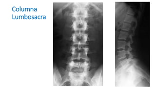 Columna
Lumbosacra
 