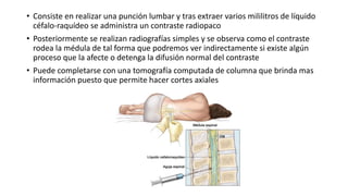 • Consiste en realizar una punción lumbar y tras extraer varios mililitros de líquido
céfalo-raquídeo se administra un contraste radiopaco
• Posteriormente se realizan radiografías simples y se observa como el contraste
rodea la médula de tal forma que podremos ver indirectamente si existe algún
proceso que la afecte o detenga la difusión normal del contraste
• Puede completarse con una tomografía computada de columna que brinda mas
información puesto que permite hacer cortes axiales
 