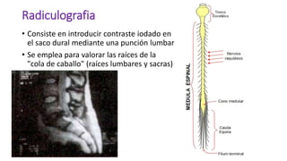 Radiculografia
• Consiste en introducir contraste iodado en
el saco dural mediante una punción lumbar
• Se emplea para valorar las raíces de la
"cola de caballo" (raíces lumbares y sacras)
 