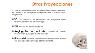 Otras Proyecciones
La mejor forma de obtener imágenes de cráneo y encéfalo
es utilizando la tomografía computarizada o la resonancia
magnética
TC: de elección en problemas de integridad ósea,
lesiones penetrantes o hemorragia
RM: aclarar los demás aspectos
Angiografía de contraste: cuando se planea
intervención quirúrgica o embolización
Ultrasonido: sólo se realizan en los bebés cuyos huesos
del cráneo no se han unido completamente
 