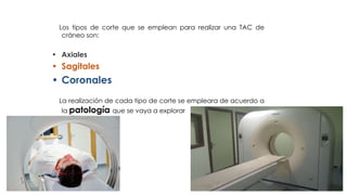Los tipos de corte que se emplean para realizar una TAC de
cráneo son:
• Axiales
• Sagitales
• Coronales
La realización de cada tipo de corte se empleara de acuerdo a
la patología que se vaya a explorar
 