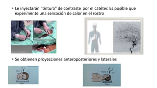 • Le inyectarán "tintura“ de contraste por el catéter. Es posible que
experimente una sensación de calor en el rostro
• Se obtienen proyecciones anteroposteriores y laterales
 