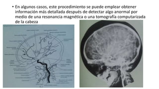 • En algunos casos, este procedimiento se puede emplear obtener
información más detallada después de detectar algo anormal por
medio de una resonancia magnética o una tomografía computarizada
de la cabeza
 