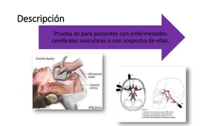 Descripción
Prueba dx para pacientes con enfermedades
cerebrales vasculares o con sospecha de ellas.
 