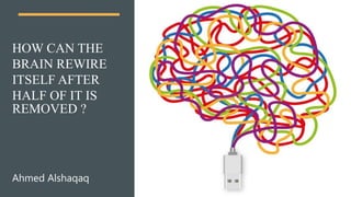 HOW CAN THE
BRAIN REWIRE
ITSELF AFTER
HALF OF IT IS
REMOVED ?
Ahmed Alshaqaq
 