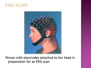 Neuroscience Methods