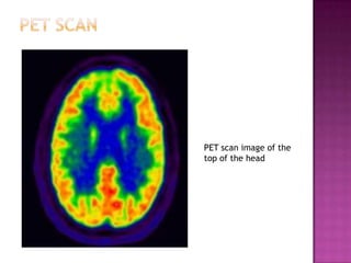 Neuroscience Methods