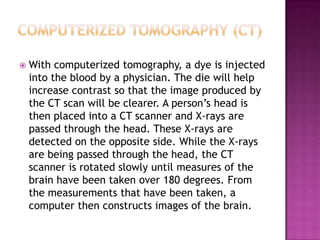 Neuroscience Methods