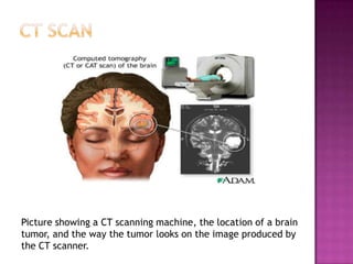 Neuroscience Methods