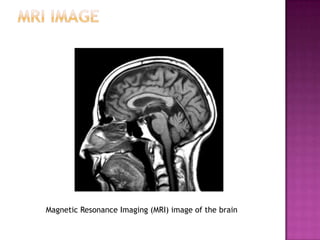 Neuroscience Methods