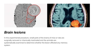 Brain lesions
In this experimental procedure, small parts of the brains of mice or rats are
surgically removed or chemically inactivated and the animals are
systematically examined to determine whether the lesion affected any memory
system.
 