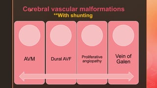 zCerebral vascular malformations
**With shunting
AVM Dural AVF Proliferative
angiopathy
Vein of
Galen
 