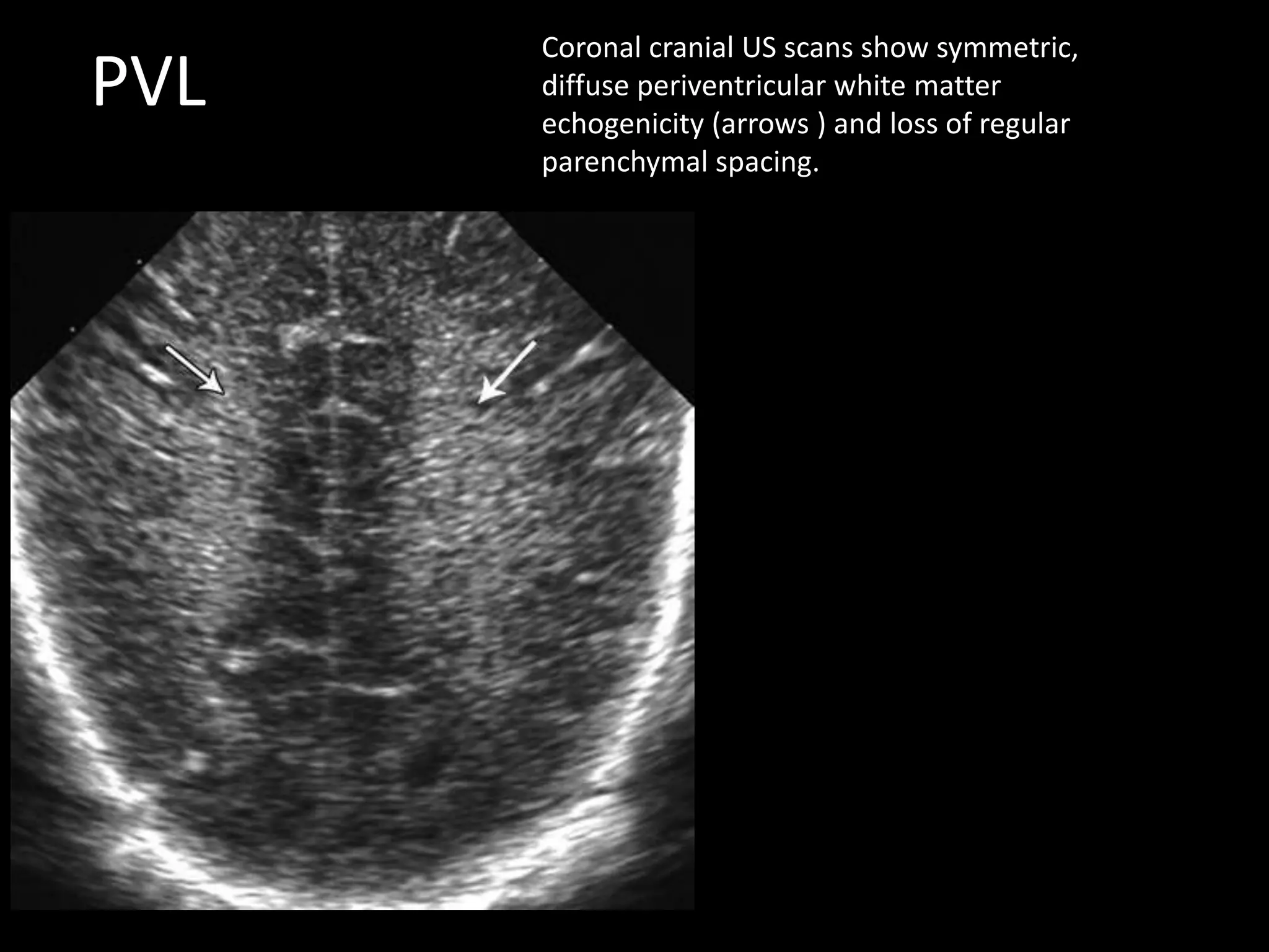 Neurosonogram.. Dr.Padmesh | PPTX