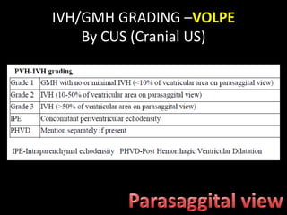 IVH/GMH GRADING –VOLPE
By CUS (Cranial US)
 