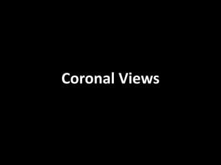 Coronal Views
 