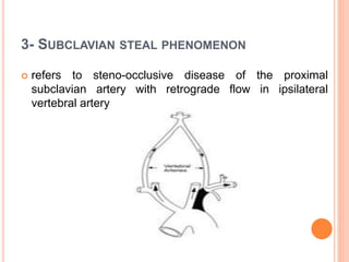 3- SUBCLAVIAN STEAL PHENOMENON
 refers to steno-occlusive disease of the proximal
subclavian artery with retrograde flow in ipsilateral
vertebral artery
 